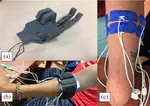 Embroidered Electrodes for Control of Affordable Myoelectric Prostheses